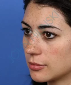 A woman with dark hair and freckles is shown in profile against a blue background.