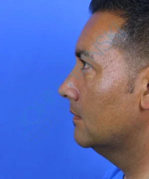 Profile view of a man with short dark hair against a blue background.