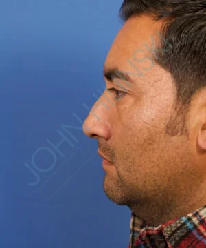 Profile view of a man with short dark hair and stubble, wearing a plaid shirt, against a blue background.