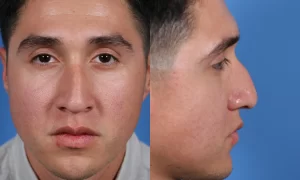 Front and side profile of a person with short dark hair against a blue background.