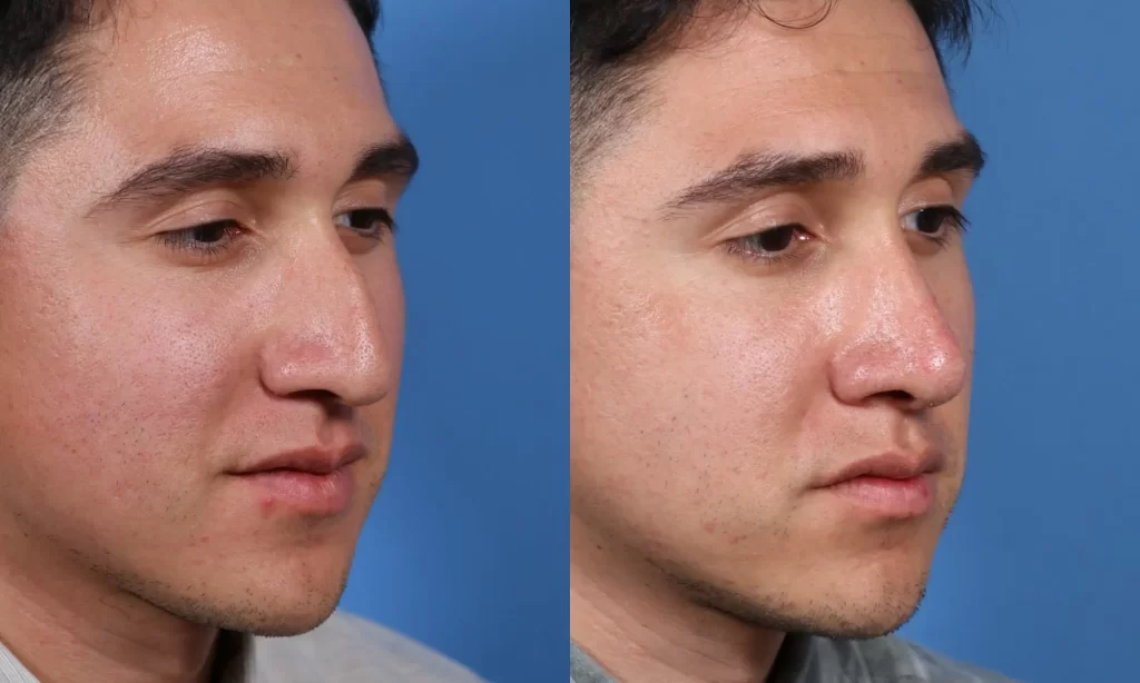 Two side-by-side images of the same person. The left image shows a person facing left, and the right image shows the same person slightly more facing forward. Blue background.