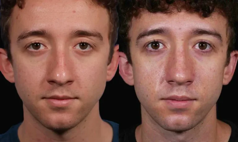 Two similar young men with curly hair and wearing dark shirts are shown in close-up portraits side by side against a black background.