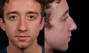 Portrait of a person with curly hair. The image shows a front view and a side profile against a black background.