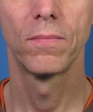 Close-up of the lower half of a man's face and neck, showing subtle facial hair and a slightly visible Adam's apple against a blue background.