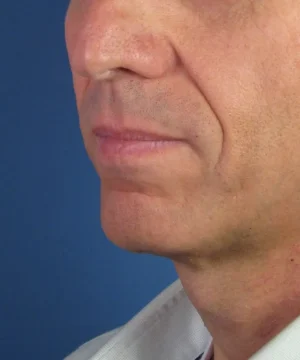 Close-up of a man's lower face with slight stubble and a neutral expression, wearing a light-colored shirt, against a blue background.