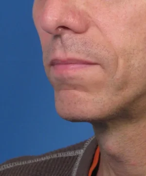 Close-up of the lower half of a person's face with stubble, wearing a brown sweater with a gray seam, set against a blue background.