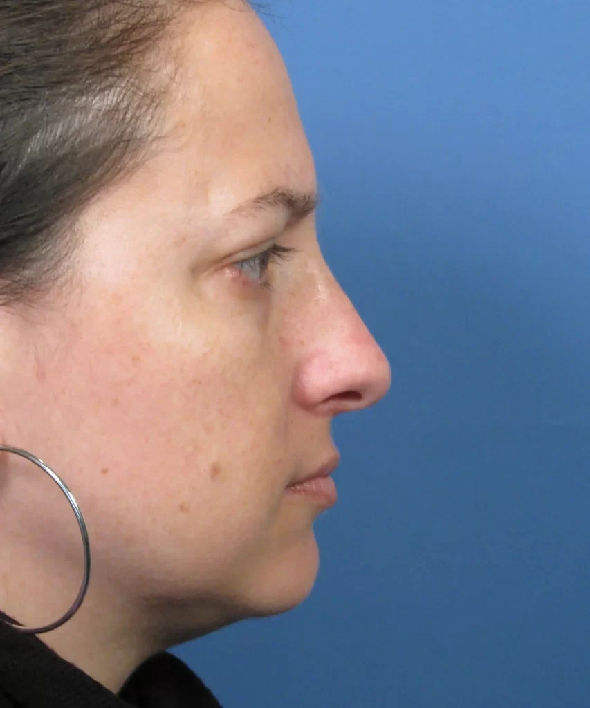 Profile view of a person with long hair pulled back, wearing a large hoop earring, against a blue background.