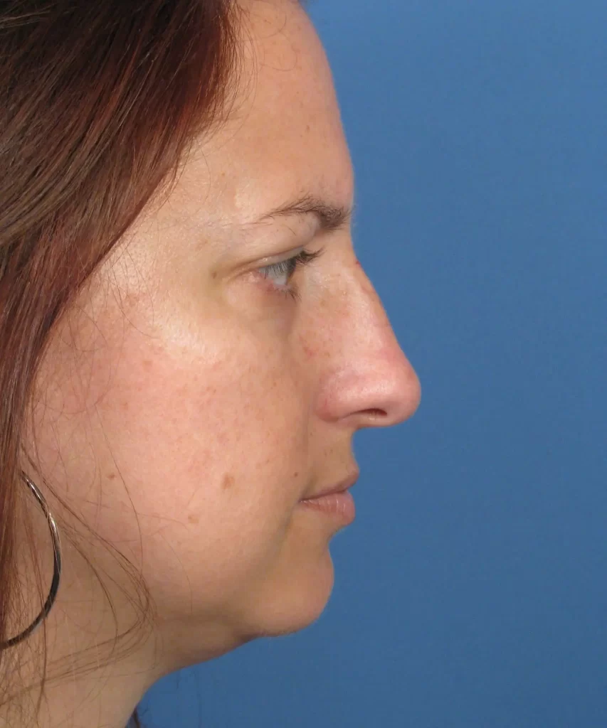 Profile view of a person with shoulder-length brown hair and visible facial features against a solid blue background.