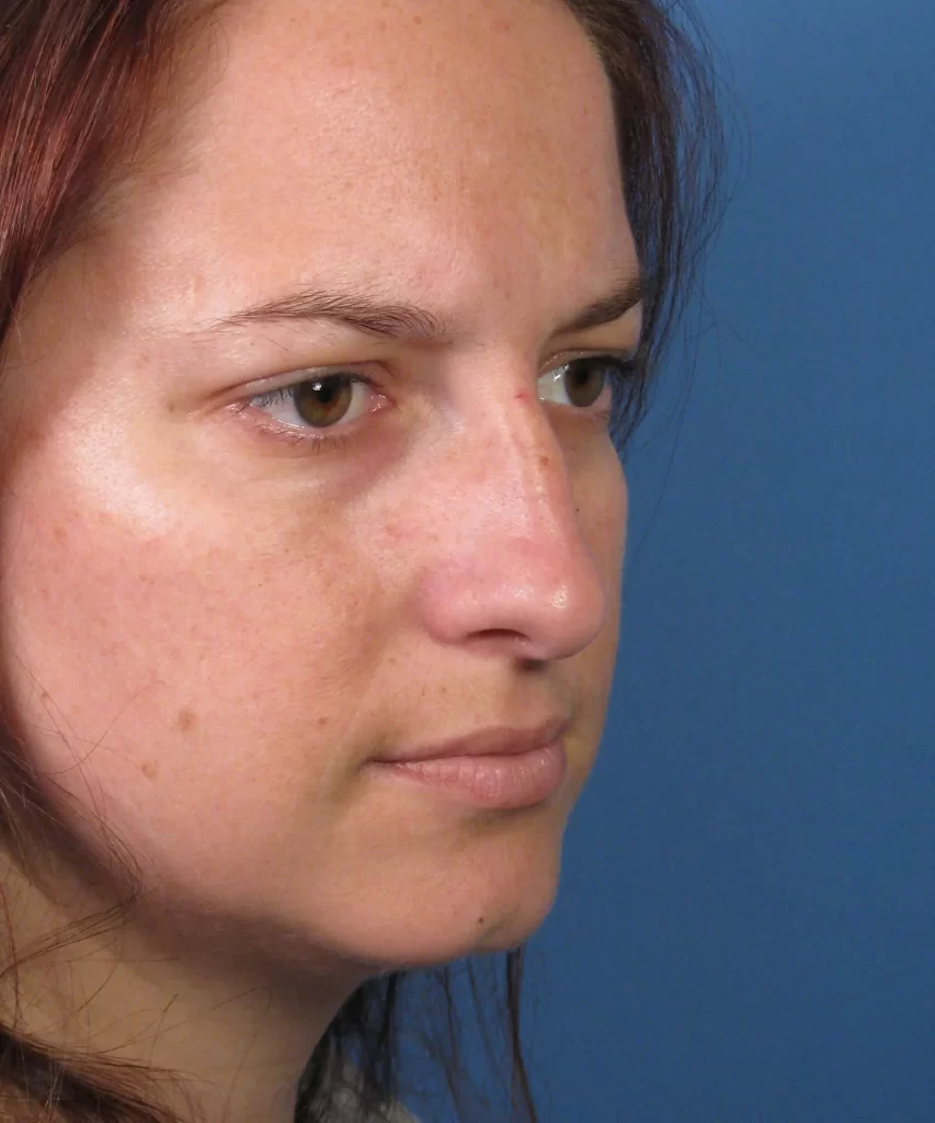 A person with long brown hair and a neutral expression is looking sideways against a blue background.