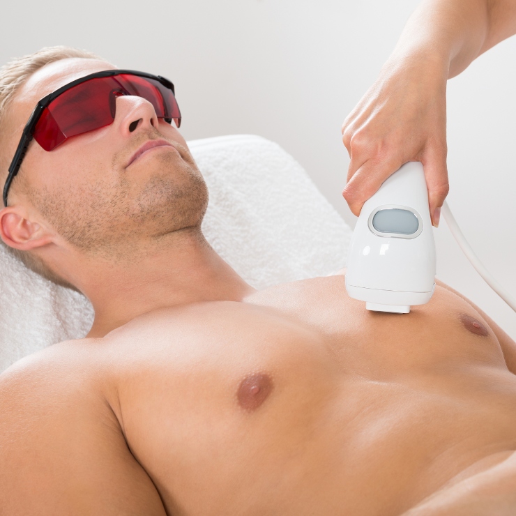 A person lying down receiving a laser hair removal treatment on their chest, wearing protective eyewear.