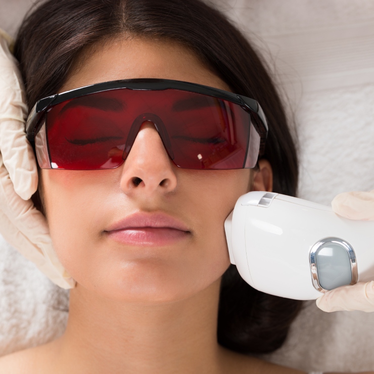 Person receiving a laser treatment on the face while wearing protective eyewear and gloves.