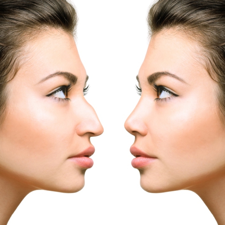 Two identical female faces in profile, facing each other against a white background.