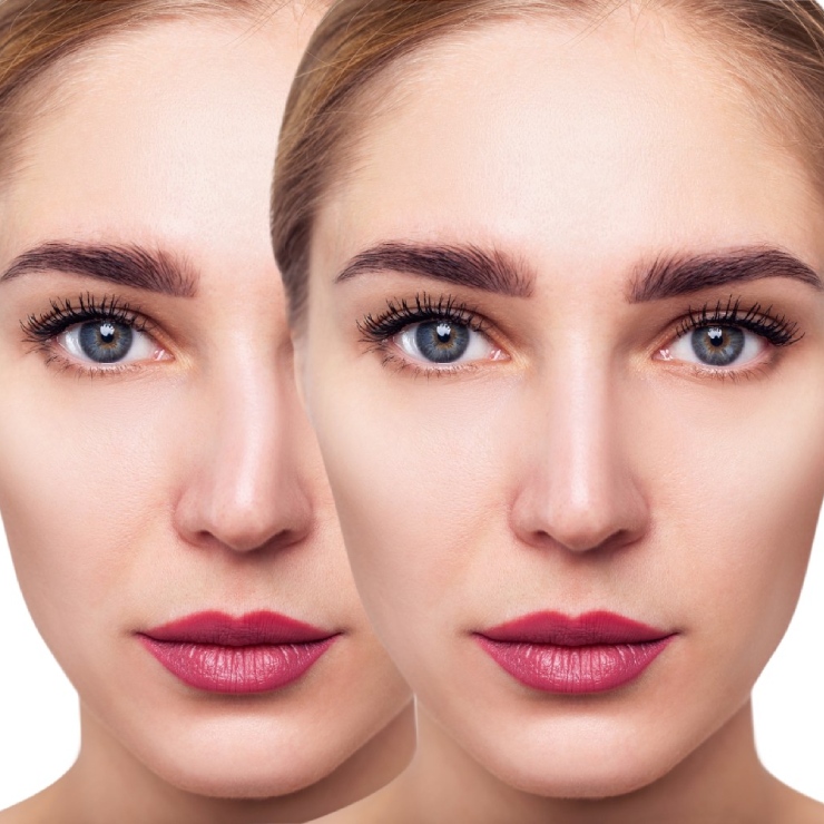 Two identical close-up portraits of a woman with light eyes, red lipstick, and smooth skin, set against a white background.