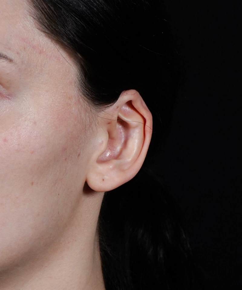 Close-up of a person's left ear against a dark background. The person has dark hair pulled back, and the ear is shown in detail.