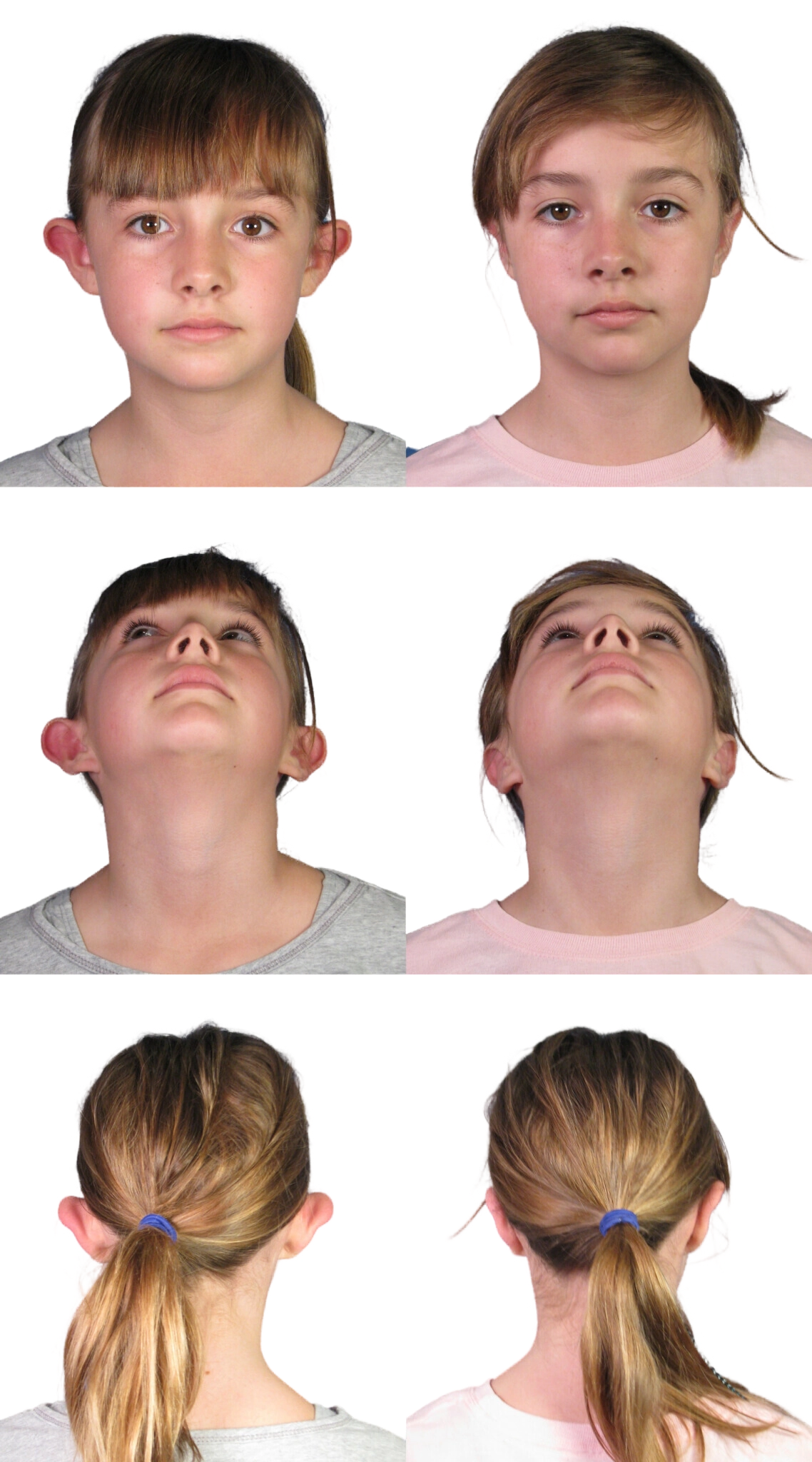 Six photos of a person from different angles: front view, chin-up view, and back view, with hair tied in a ponytail, against a plain background.