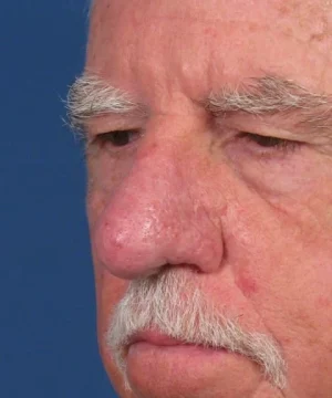 Close-up of an older man with a prominent nose and mustache, looking downward against a blue background.