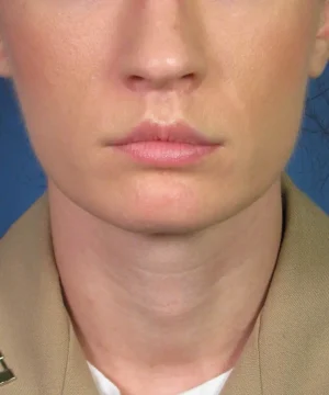 Close-up of a person wearing a beige uniform, showing the lower half of their face against a blue background.