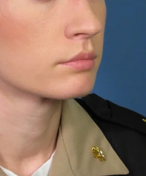 Close-up of a person in a military uniform, showing a partial view of the face and collar with insignia against a blue background.