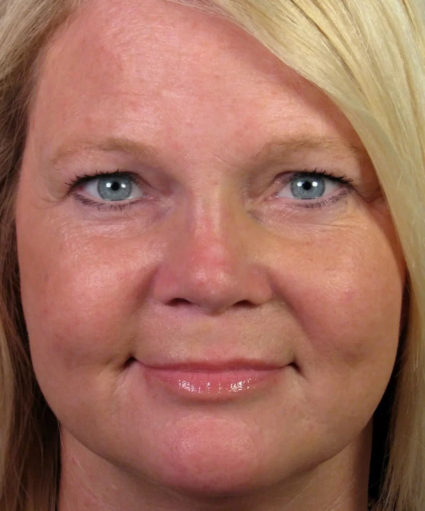 Close-up of a person with blonde hair and blue eyes, smiling slightly. The focus is on the face, showing clear skin and light makeup.