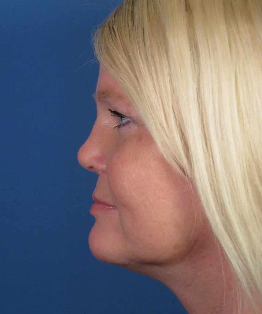 Profile view of a person with long blonde hair against a blue background.