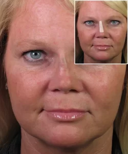 Close-up of a woman's face with focus on skin texture and light makeup. Inset shows the same woman with a strip placed vertically on her nose, against a plain background.