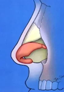 Illustration of a human nasal cavity cross-section showing the anatomy of the nose including the nasal passage, septum, and sinuses.