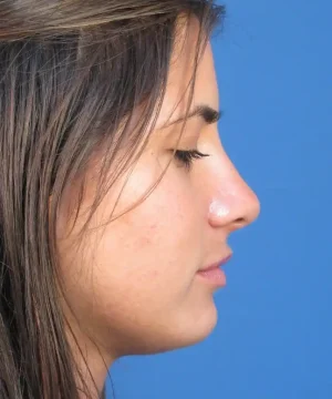 Profile view of a woman with closed eyes against a blue background.