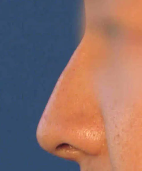 Close-up side view of a person's nose against a blue background.