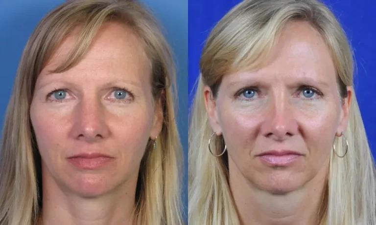 Two side-by-side photos of a woman with long blonde hair and blue eyes. The left image shows a neutral expression, while the right image shows a slight frown.