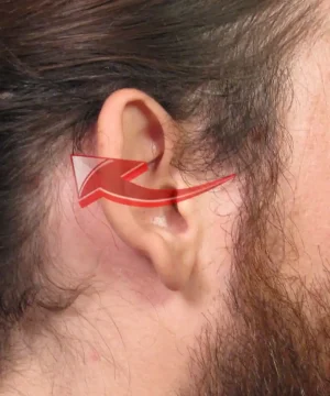 Close-up image of a person's ear with a red arrow pointing towards it, indicating a focus on the ear anatomy or a related feature.