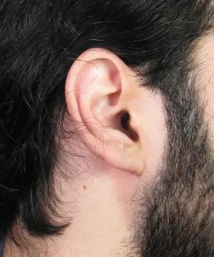 Close-up of a person's ear with dark hair surrounding it, showing skin texture and detail.