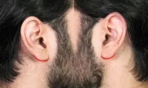 Close-up of two human ears with red curved lines drawn beneath them. The ears and hair appear in a mirrored, symmetrical arrangement.