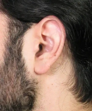 Close-up of the side of a person's head, showing an ear and dark hair.