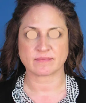 A person with shoulder-length hair against a blue background, wearing a polka-dot blouse and black cardigan. Eyes are digitally obscured.