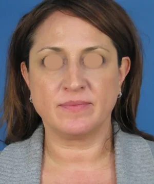 A woman with medium-length brown hair is wearing a gray sweater against a blue background. The eyes are blurred for privacy.