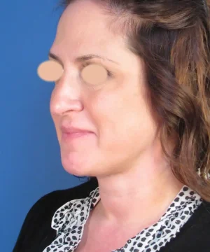 Side profile of a person with eyes obscured, wearing a black top and patterned shirt, against a blue background.