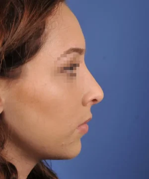 Side profile of a person with pixelated eyes against a blue background.