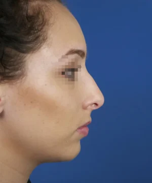 Side profile of a person against a blue background, with their face slightly obscured for privacy.