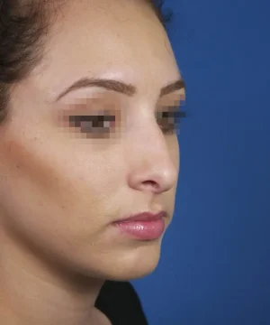 Profile view of a person with pixelated eyes against a blue background, showing facial features and expression in a neutral tone.