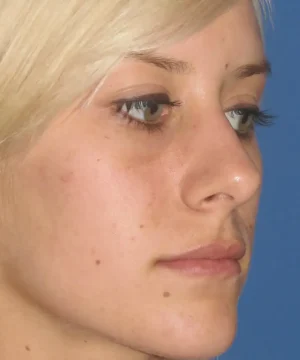 Profile view of a person with light hair against a blue background.