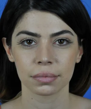 A woman with medium-length dark hair stares directly at the camera against a blue background.