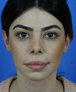 A person with dark hair and eyebrows, wearing a light-colored top, is photographed against a blue background.