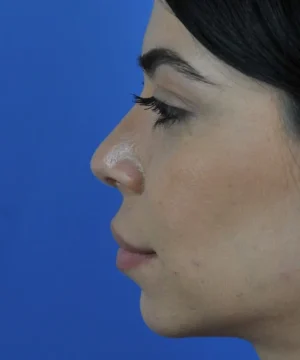 Profile view of a person with closed eyes against a solid blue background.