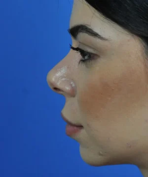 Side profile of a person with dark hair against a blue background.