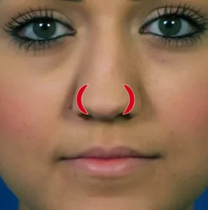 Close-up of a person's face, focusing on the nose with red curved lines highlighting the nostrils.