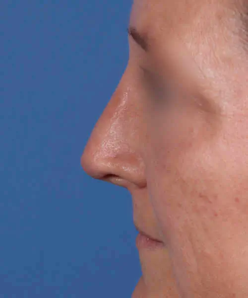 Side profile of a person's face against a blue background, focusing on the nose and blurred eye area.