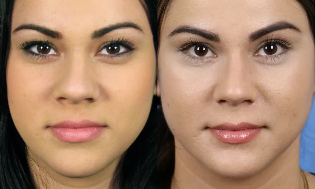 Close-up of two women's faces side by side, showcasing differences in makeup or lighting. Both have dark hair and similar features.