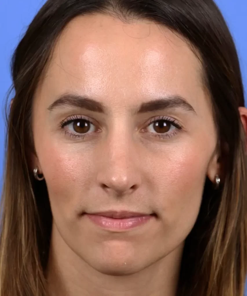 A person with long brown hair and brown eyes against a blue background.