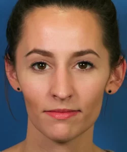 Portrait of a person with a neutral expression against a blue background.