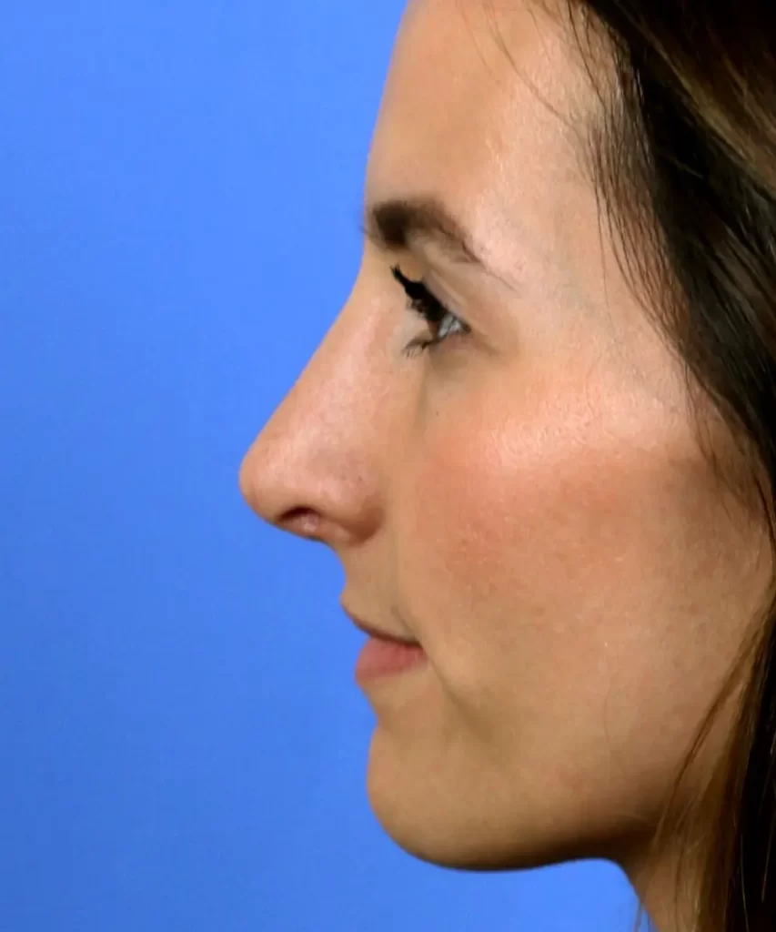 Side profile of a person with dark hair against a blue background.